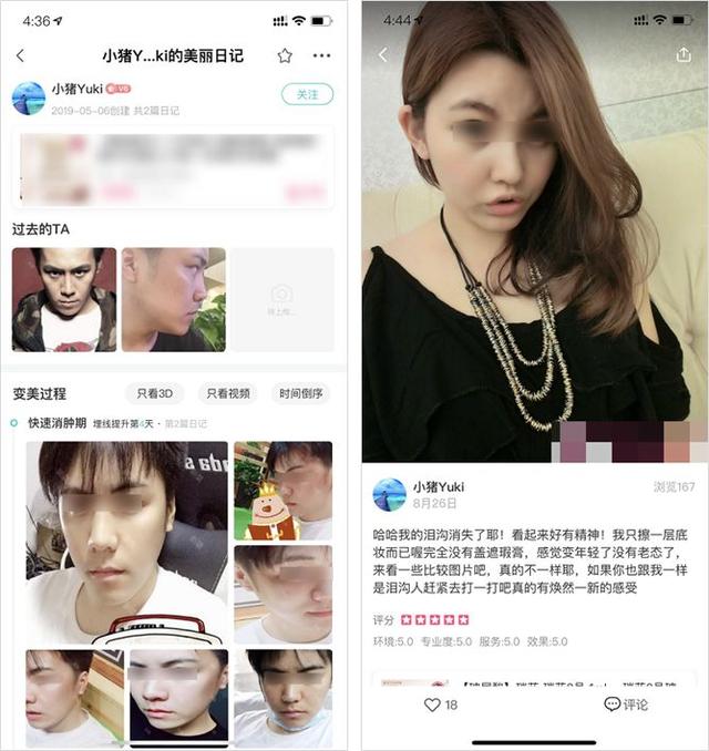 被骂惨的医美广告背后,藏着哪些行业内幕?